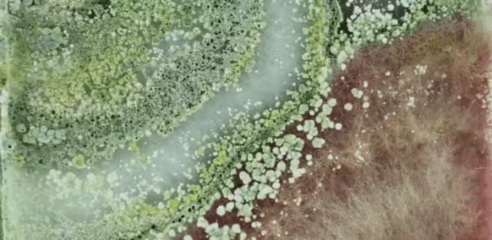 L’espoir des nanoparticules d’argent : une solution aux infections virales ignorée par Big Pharma ?
